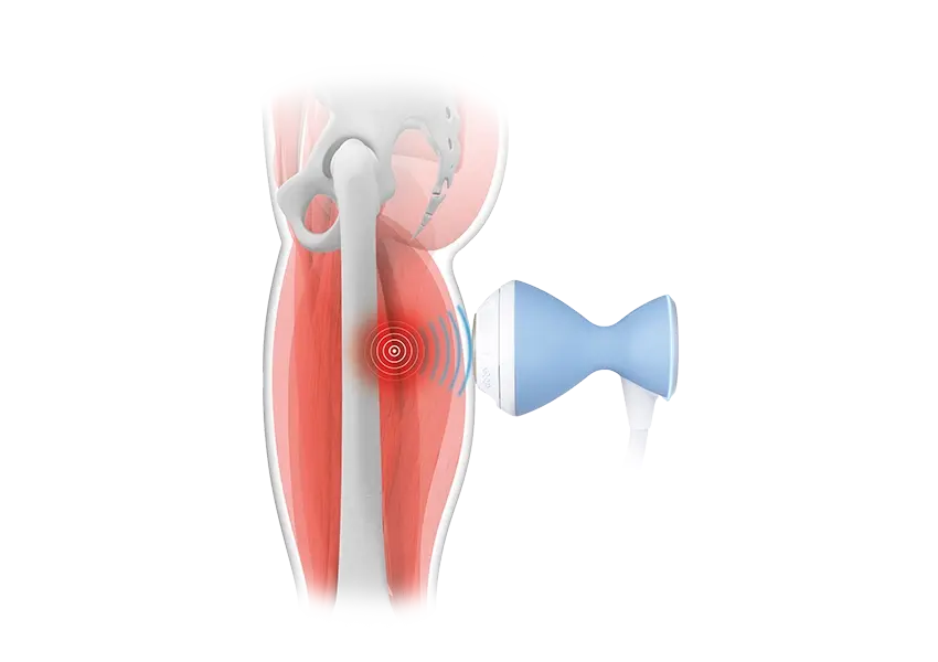BTL_Shockwave-Focused_FSWT
