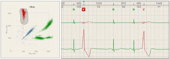 Cardio-PoinCare-study