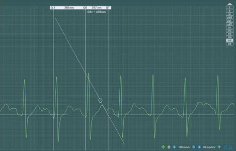 Cardio-QT-study