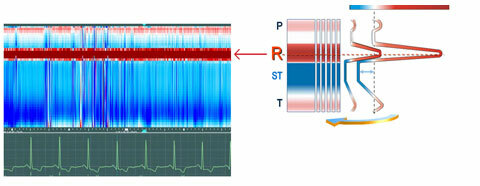Cardio-Relief-map-Study