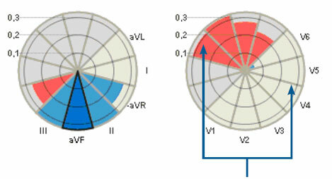 Cardio-ST-Maps-Study