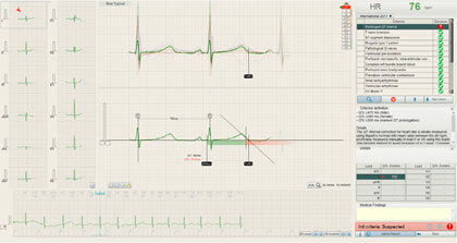 cardio-Covid-studi-1