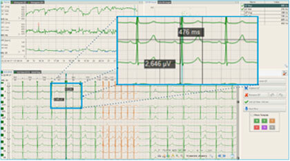 cardio-Covid-studi-2