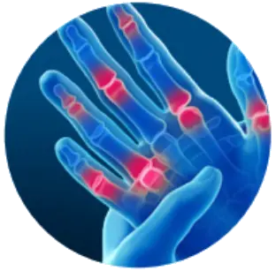 Артроз мелких суставов пальцев