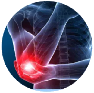 Локтевой/лучевой эпикондилит