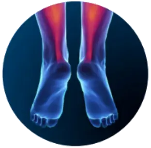 Ахиллодиния